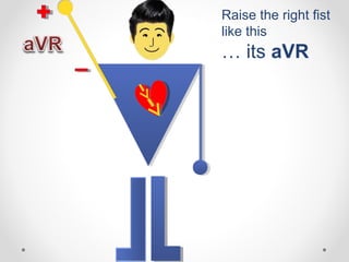 Raise the right fist
like this
… its aVR
 