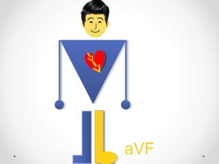 aVF
 