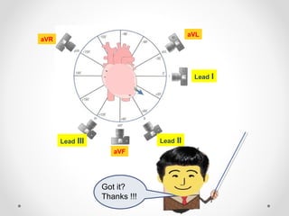 Lead I
aVL
Lead III Lead II
aVR
aVF
Got it?
Thanks !!!
 