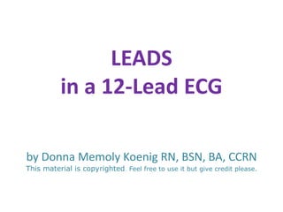 LEADS
           in a 12-Lead ECG

by Donna Memoly Koenig RN, BSN, BA, CCRN
This material is copyrighted.. Feel free to use it but give credit please.
 