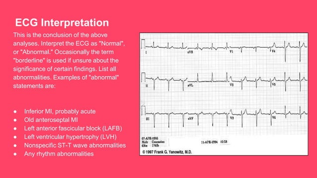 Method of ECG Interpretation | PPTX | Heart and Cardiovascular Diseases ...