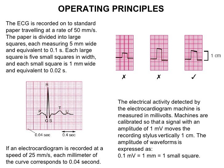 normal paper scale voltage calibration for ecg graph paper barca normal paper scale voltage calibration for ecg graph paper