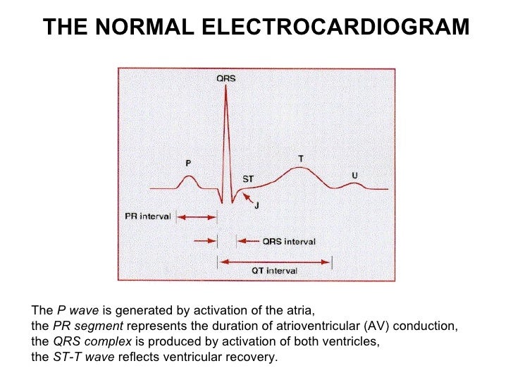 Ecg lecture