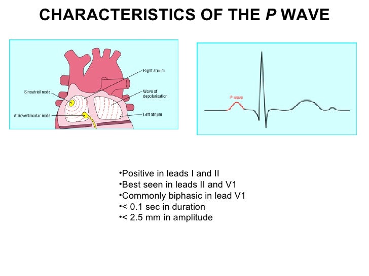 p wave ecg magdalene project org p wave ecg
