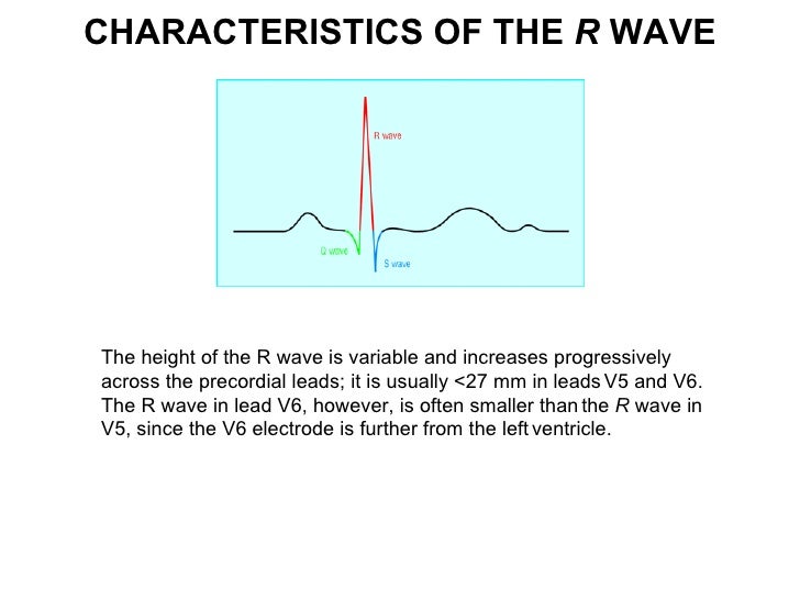 ecg lecture