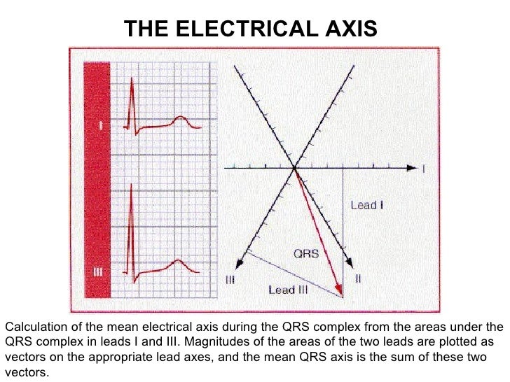 Ecg lecture