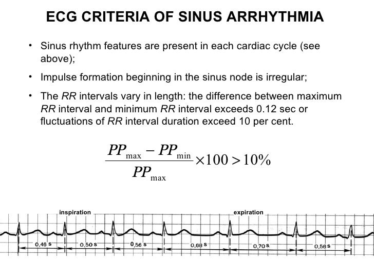 Ecg Lecture