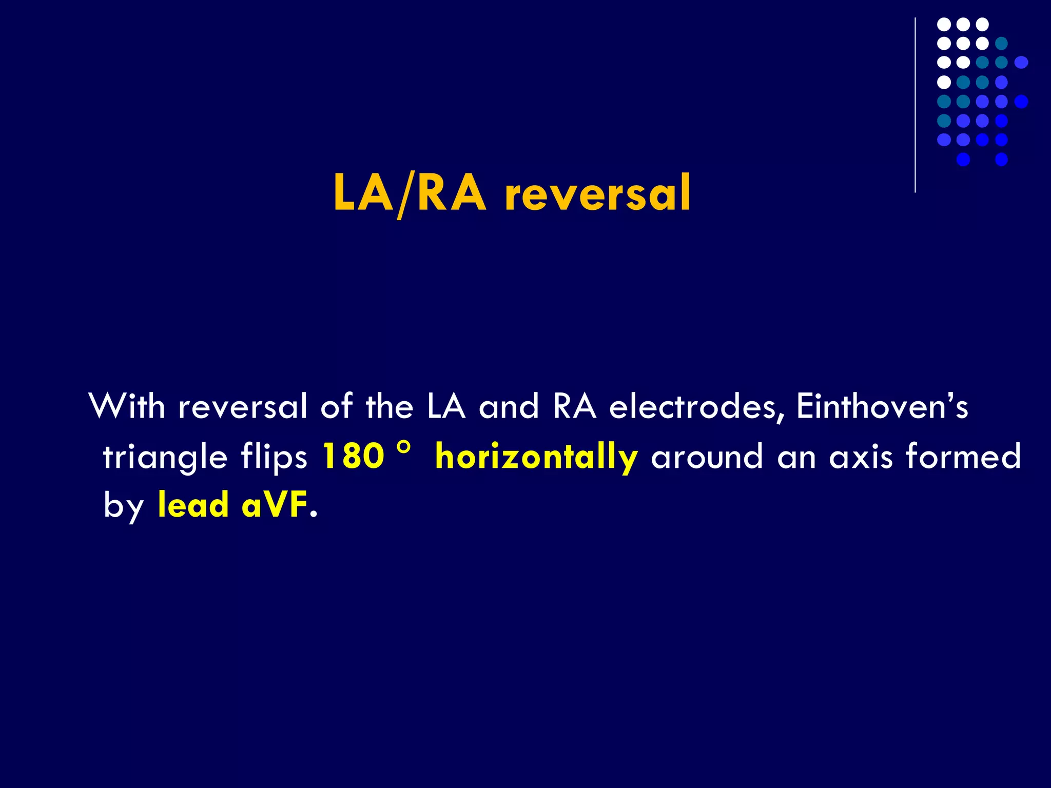 LA/RA reversal
With reversal of the LA and RA electrodes, Einthoven’s
triangle flips 180  horizontally around an axis formed
by lead aVF.
 