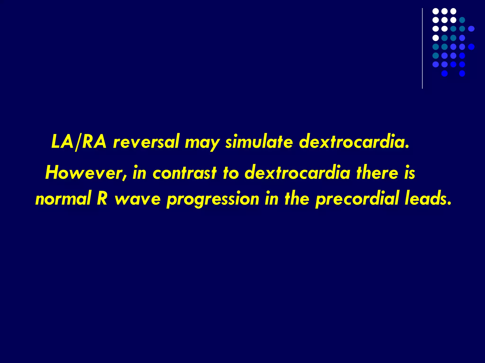 LA/RA reversal may simulate dextrocardia.
However, in contrast to dextrocardia there is
normal R wave progression in the precordial leads.
 