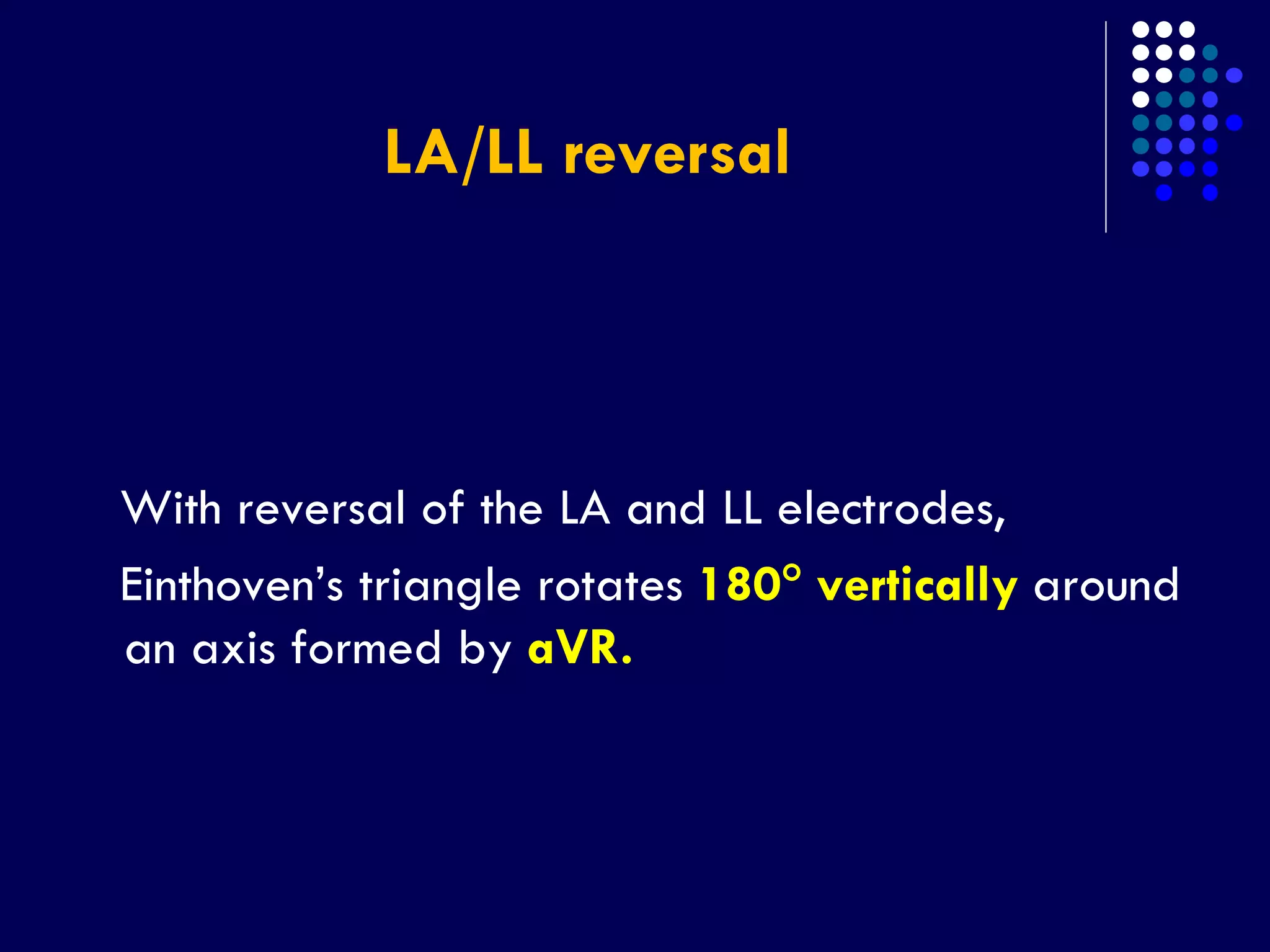 LA/LL reversal
With reversal of the LA and LL electrodes,
Einthoven’s triangle rotates 180 vertically around
an axis formed by aVR.
 