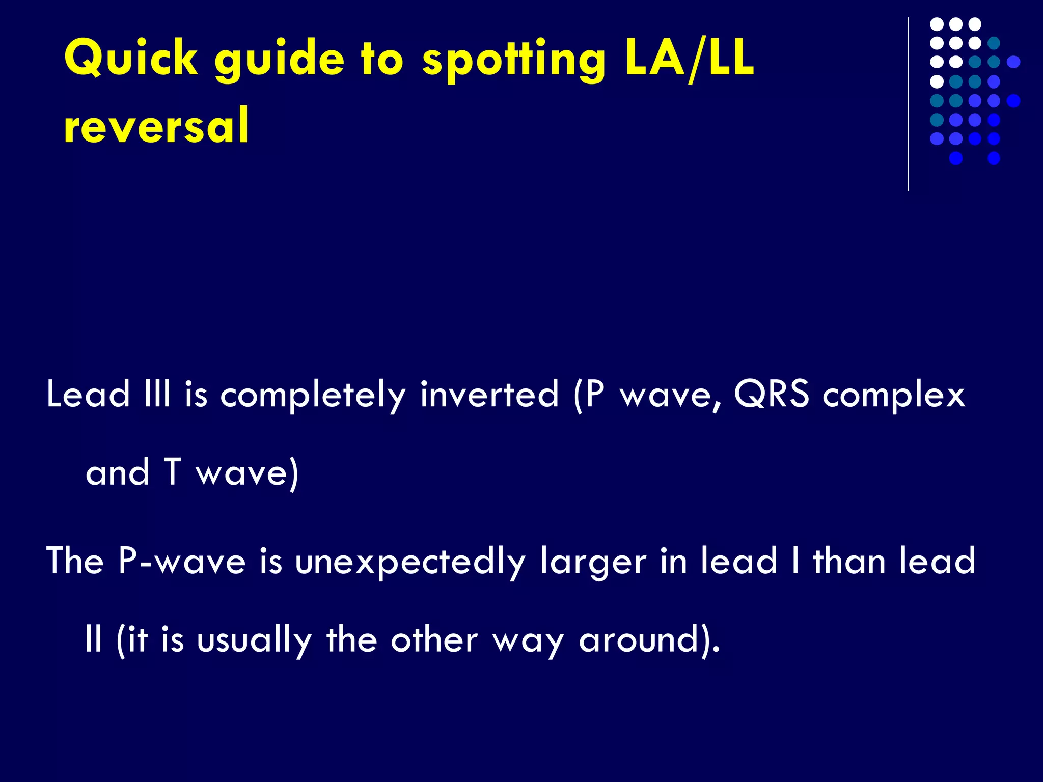 Quick guide to spotting LA/LL
reversal
Lead III is completely inverted (P wave, QRS complex
and T wave)
The P-wave is unexpectedly larger in lead I than lead
II (it is usually the other way around).
 