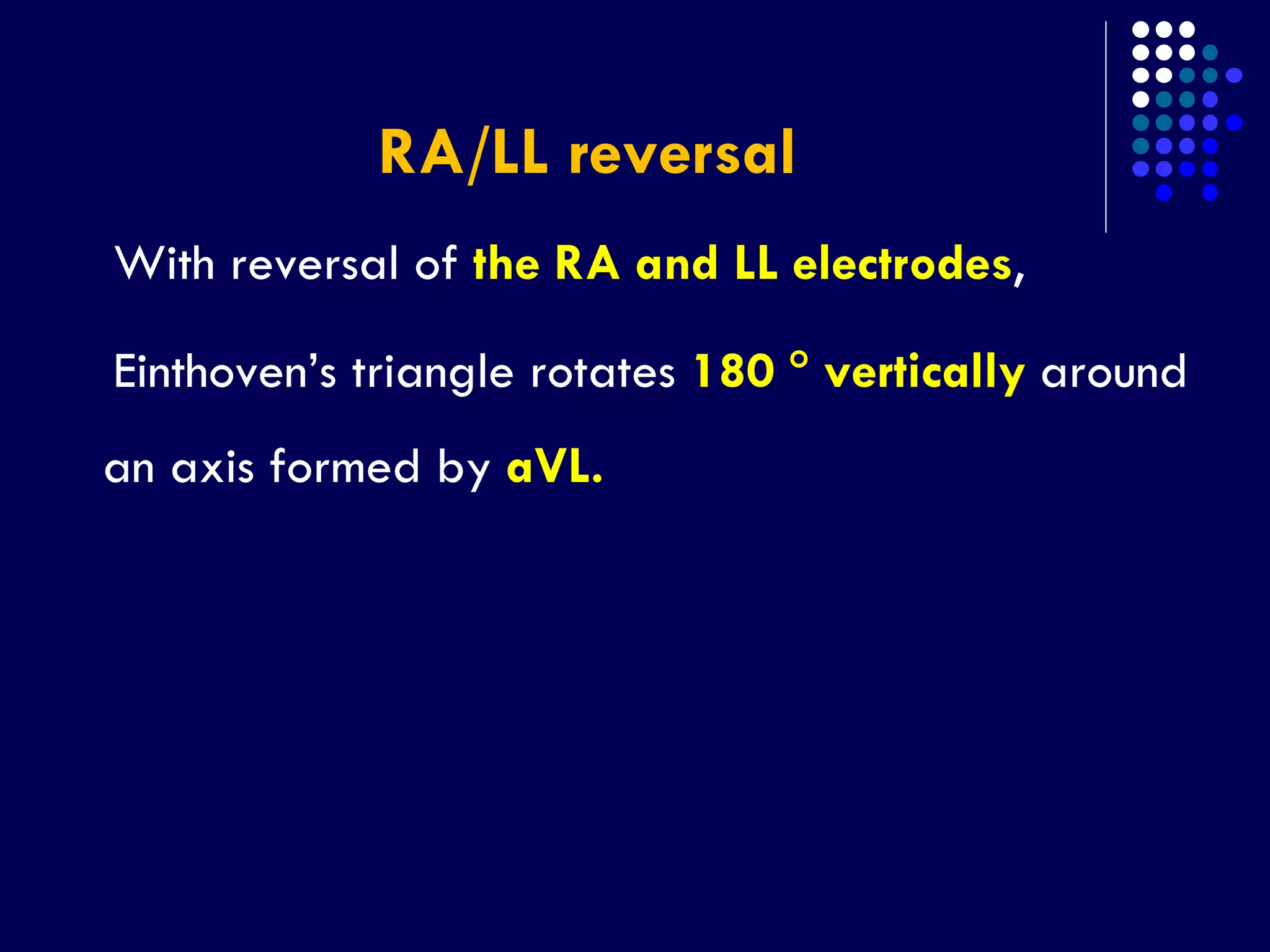 RA/LL reversal
With reversal of the RA and LL electrodes,
Einthoven’s triangle rotates 180  vertically around
an axis formed by aVL.
 