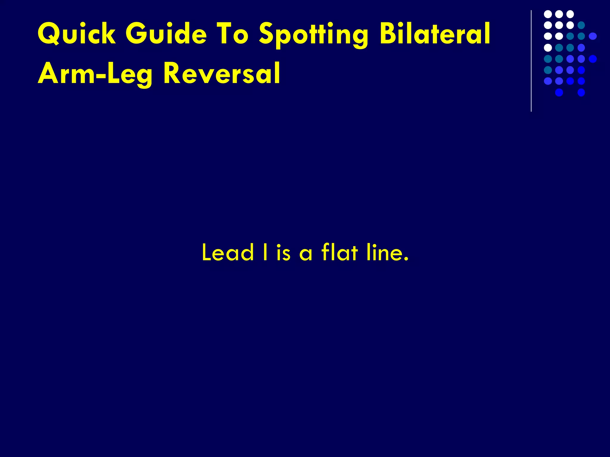 Quick Guide To Spotting Bilateral
Arm-Leg Reversal
Lead I is a flat line.
 