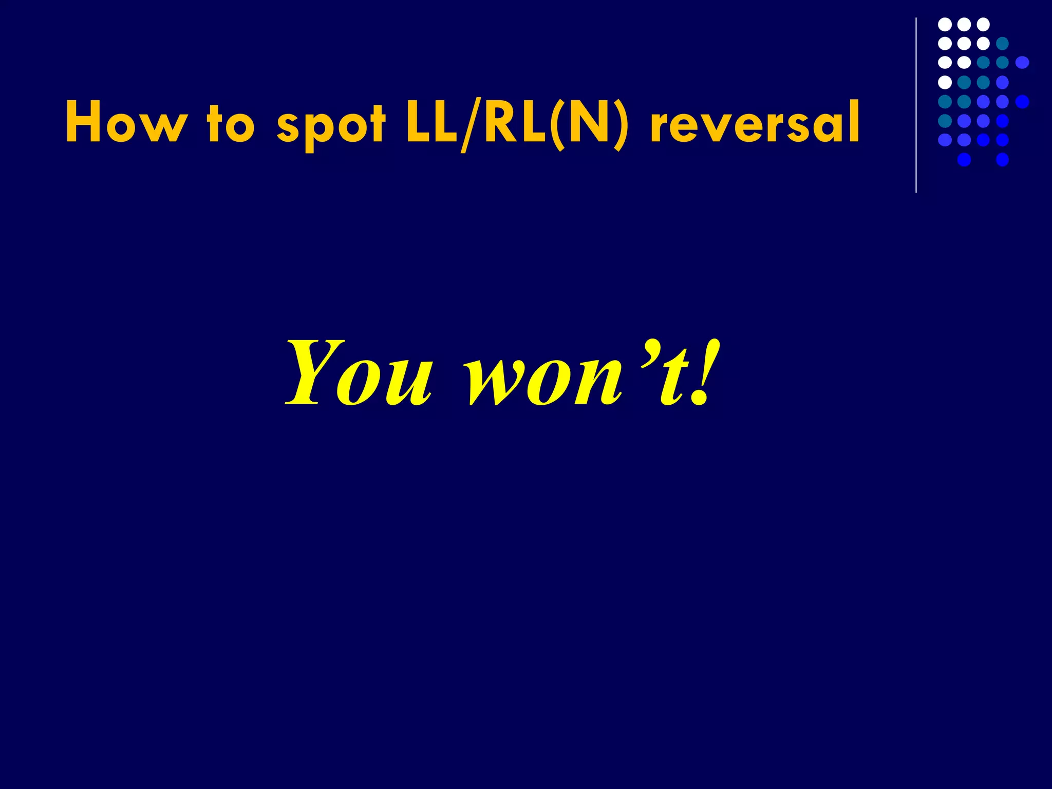 How to spot LL/RL(N) reversal
You won’t!
 