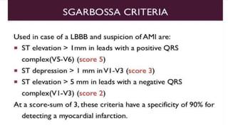 Ecg localization of myocardial infarction | PPTX