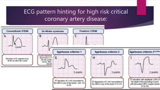 Ecg localization of myocardial infarction | PPTX