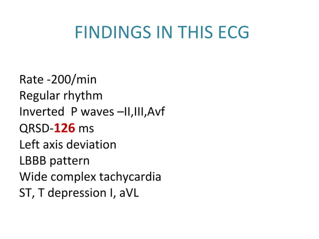 ECG: Wide Complex Tachycardia | PPT