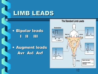 12
LIMB LEADSLIMB LEADS
• Bipolar leadsBipolar leads
I II IIII II III
• Augment leadsAugment leads
Avr Avl AvfAvr Avl Avf
 
 