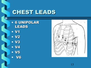 13
CHEST LEADSCHEST LEADS
• 6 UNIPOLAR6 UNIPOLAR
LEADSLEADS
• V1V1
• V2V2
• V3V3
• V4V4
• V5V5
• V6V6
 
