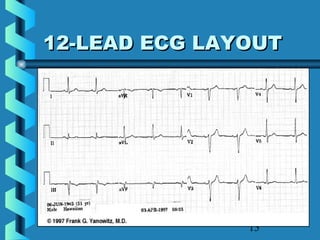 15
12-LEAD ECG LAYOUT12-LEAD ECG LAYOUT
 