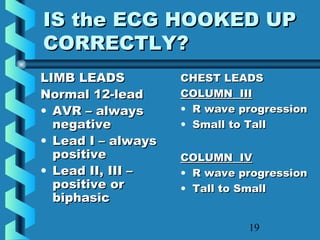 19
IS the ECG HOOKED UPIS the ECG HOOKED UP
CORRECTLY?CORRECTLY?
LIMB LEADSLIMB LEADS
Normal 12-leadNormal 12-lead
• AVR – alwaysAVR – always
negativenegative
• Lead I – alwaysLead I – always
positivepositive
• Lead II, III –Lead II, III –
positive orpositive or
biphasicbiphasic
CHEST LEADSCHEST LEADS
COLUMN IIICOLUMN III
• R wave progressionR wave progression
• Small to TallSmall to Tall
COLUMN IVCOLUMN IV
• R wave progressionR wave progression
• Tall to SmallTall to Small
 