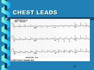 23
CHEST LEADSCHEST LEADS
 