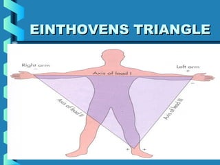 29
EINTHOVENS TRIANGLEEINTHOVENS TRIANGLE
 