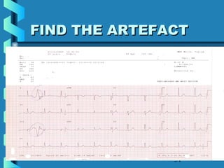 31
FIND THE ARTEFACTFIND THE ARTEFACT
 