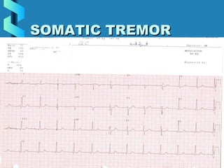 33
SOMATIC TREMORSOMATIC TREMOR
 
