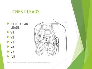CHEST LEADS
 6 UNIPOLAR
LEADS
 V1
 V2
 V3
 V4
 V5
 V6
JERIN.T.S, 3RD YEAR BSC NURSING, KRSMCON MANGALORE. PH:+919496743672
 