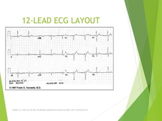 12-LEAD ECG LAYOUT
JERIN.T.S, 3RD YEAR BSC NURSING, KRSMCON MANGALORE. PH:+919496743672
 