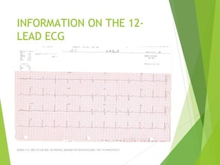 INFORMATION ON THE 12-
LEAD ECG
JERIN.T.S, 3RD YEAR BSC NURSING, KRSMCON MANGALORE. PH:+919496743672
 