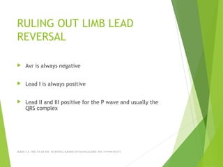 RULING OUT LIMB LEAD
REVERSAL
 Avr is always negative
 Lead I is always positive
 Lead II and III positive for the P wave and usually the
QRS complex
JERIN.T.S, 3RD YEAR BSC NURSING, KRSMCON MANGALORE. PH:+919496743672
 