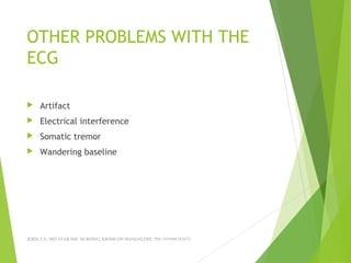 OTHER PROBLEMS WITH THE
ECG
 Artifact
 Electrical interference
 Somatic tremor
 Wandering baseline
JERIN.T.S, 3RD YEAR BSC NURSING, KRSMCON MANGALORE. PH:+919496743672
 