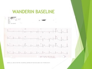 WANDERIN BASELINE
JERIN.T.S, 3RD YEAR BSC NURSING, KRSMCON MANGALORE. PH:+919496743672
 