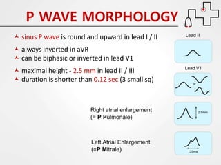 Ecg made easy | PDF