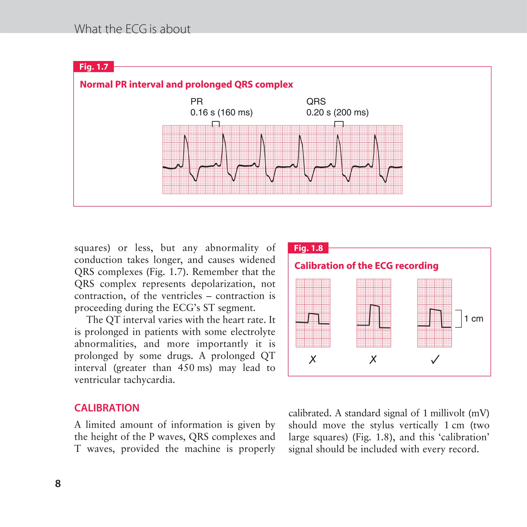 The ECG made easy guide. Guide on how to read ECG's quick and ...