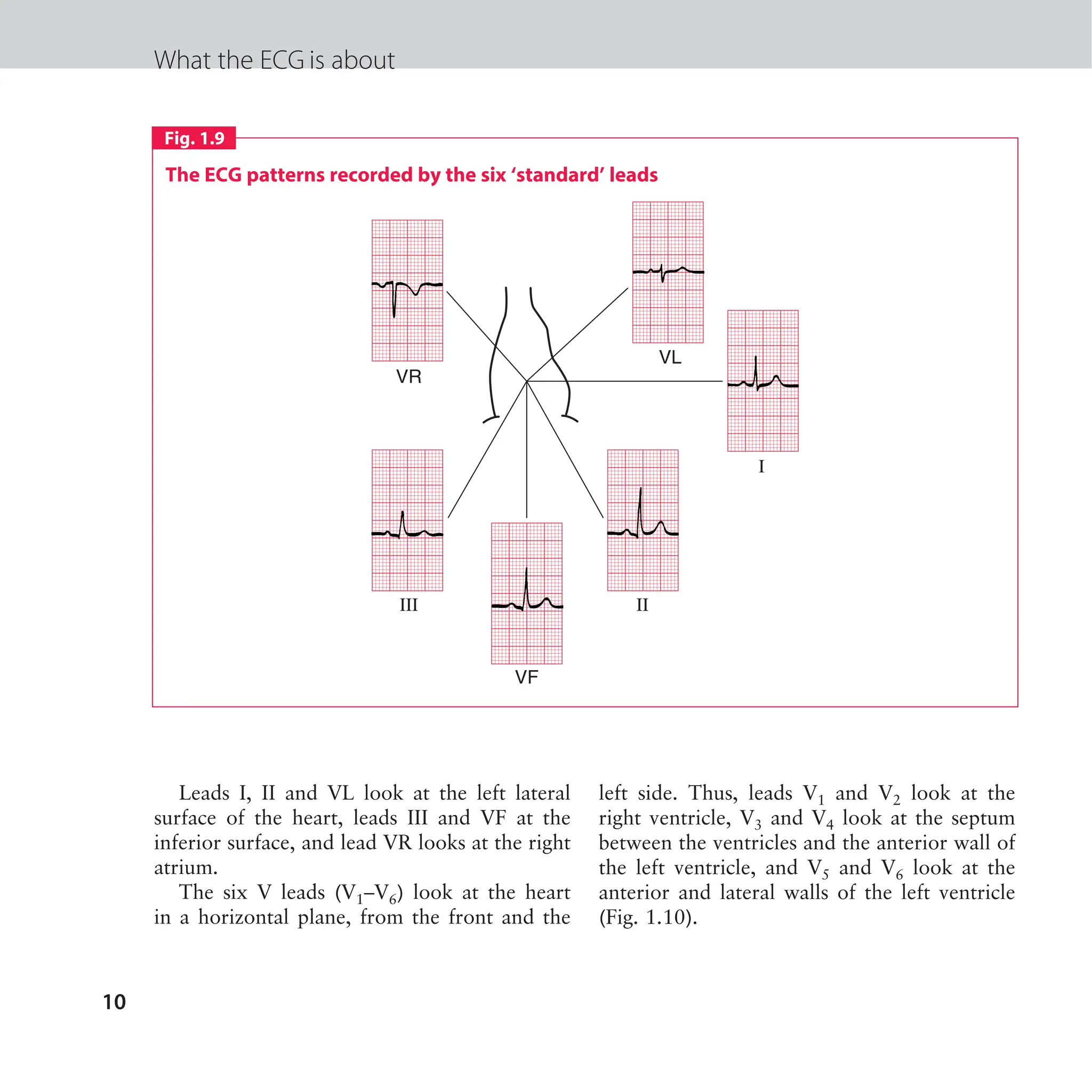 The ECG made easy guide. Guide on how to read ECG's quick and ...