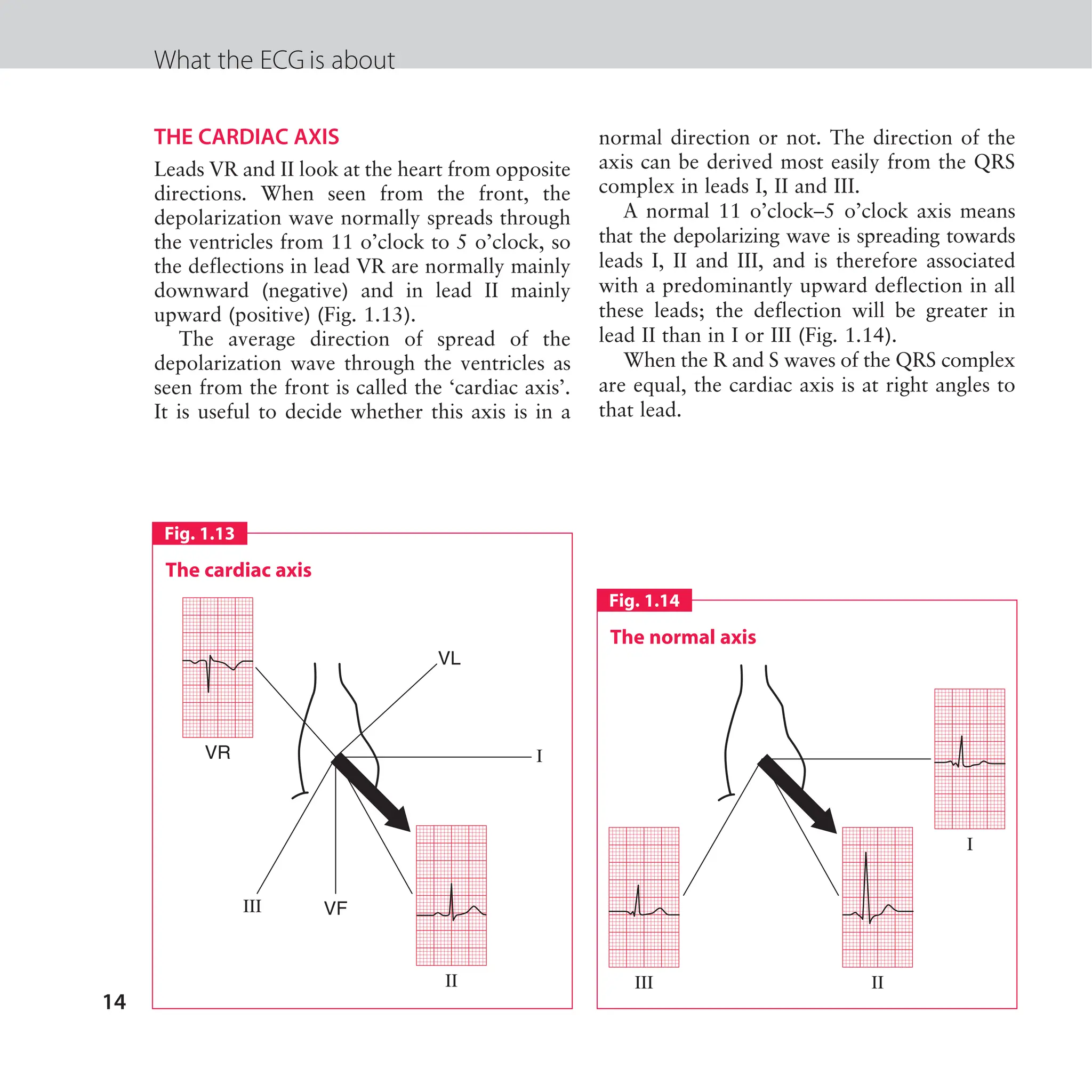 The ECG made easy guide. Guide on how to read ECG's quick and ...