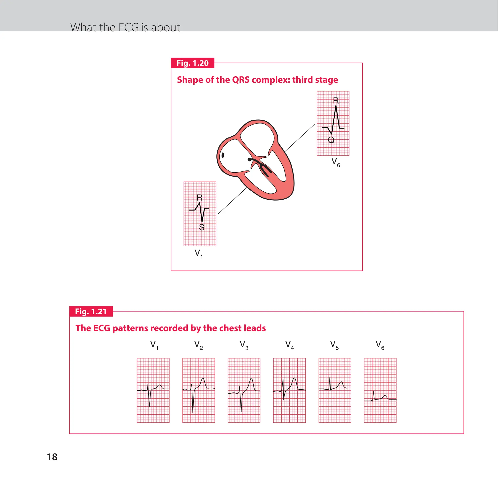The ECG made easy guide. Guide on how to read ECG's quick and ...