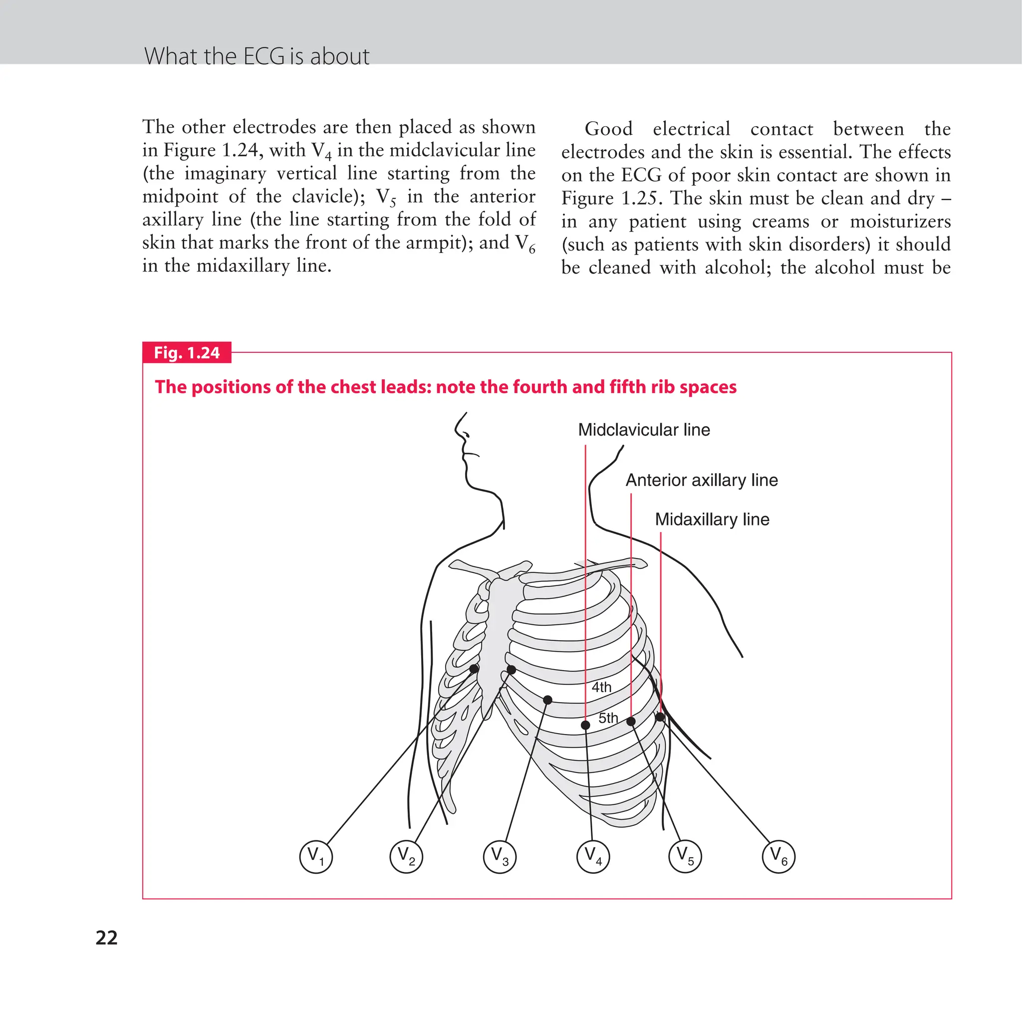 The ECG made easy guide. Guide on how to read ECG's quick and ...