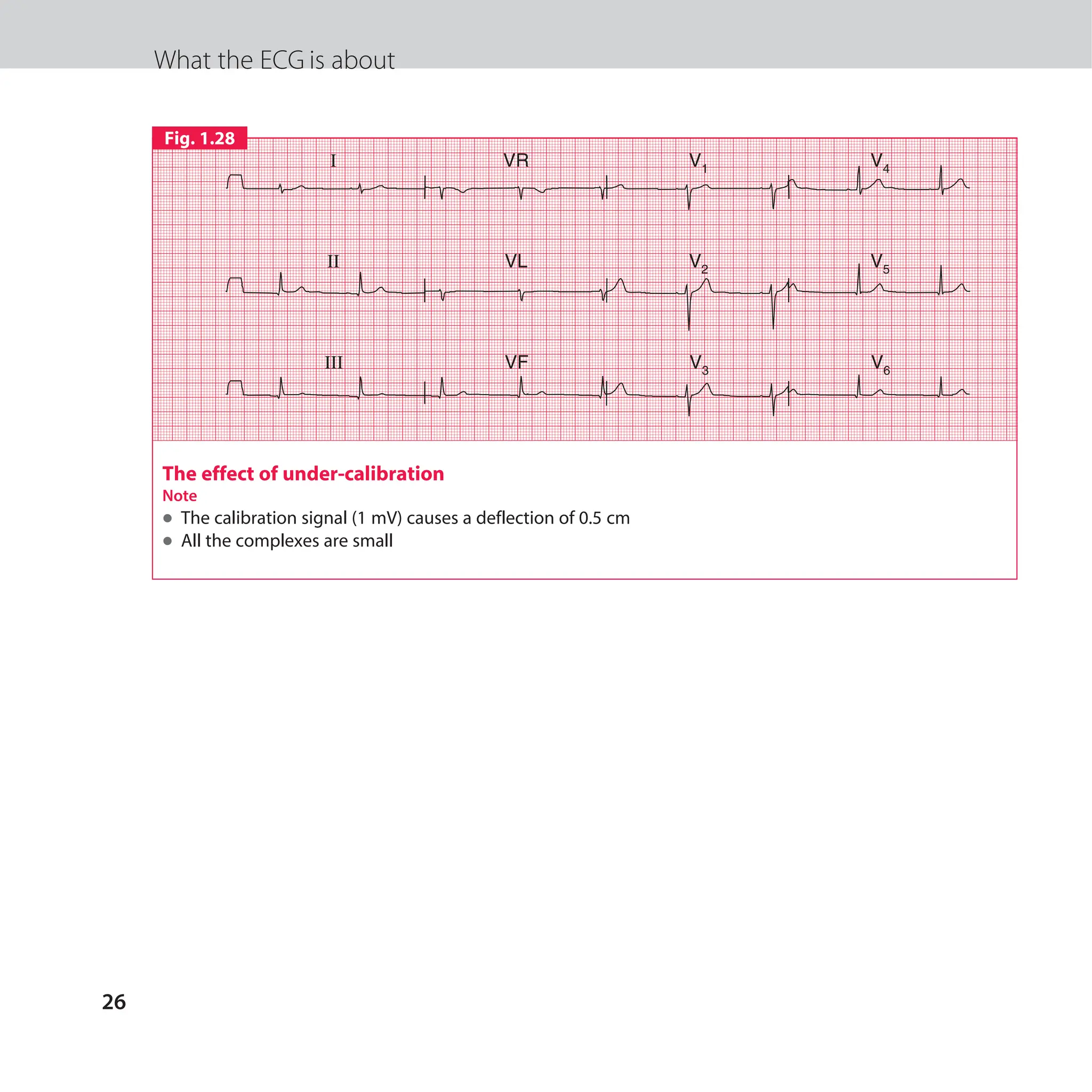 The ECG made easy guide. Guide on how to read ECG's quick and ...