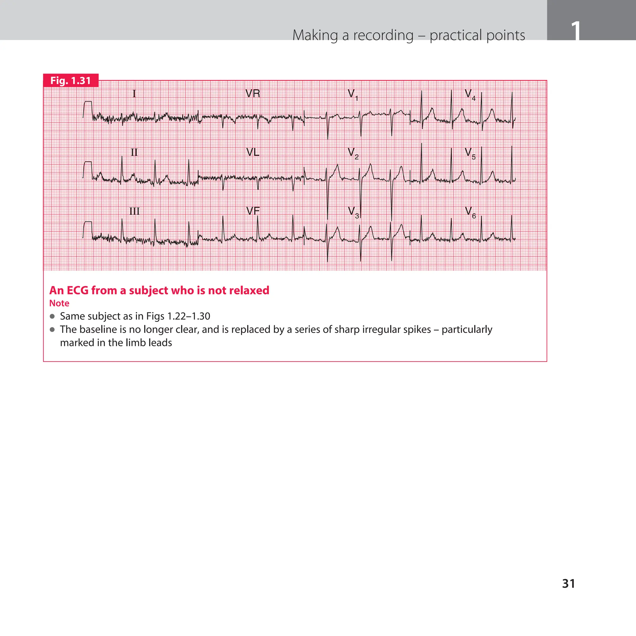 The ECG made easy guide. Guide on how to read ECG's quick and ...