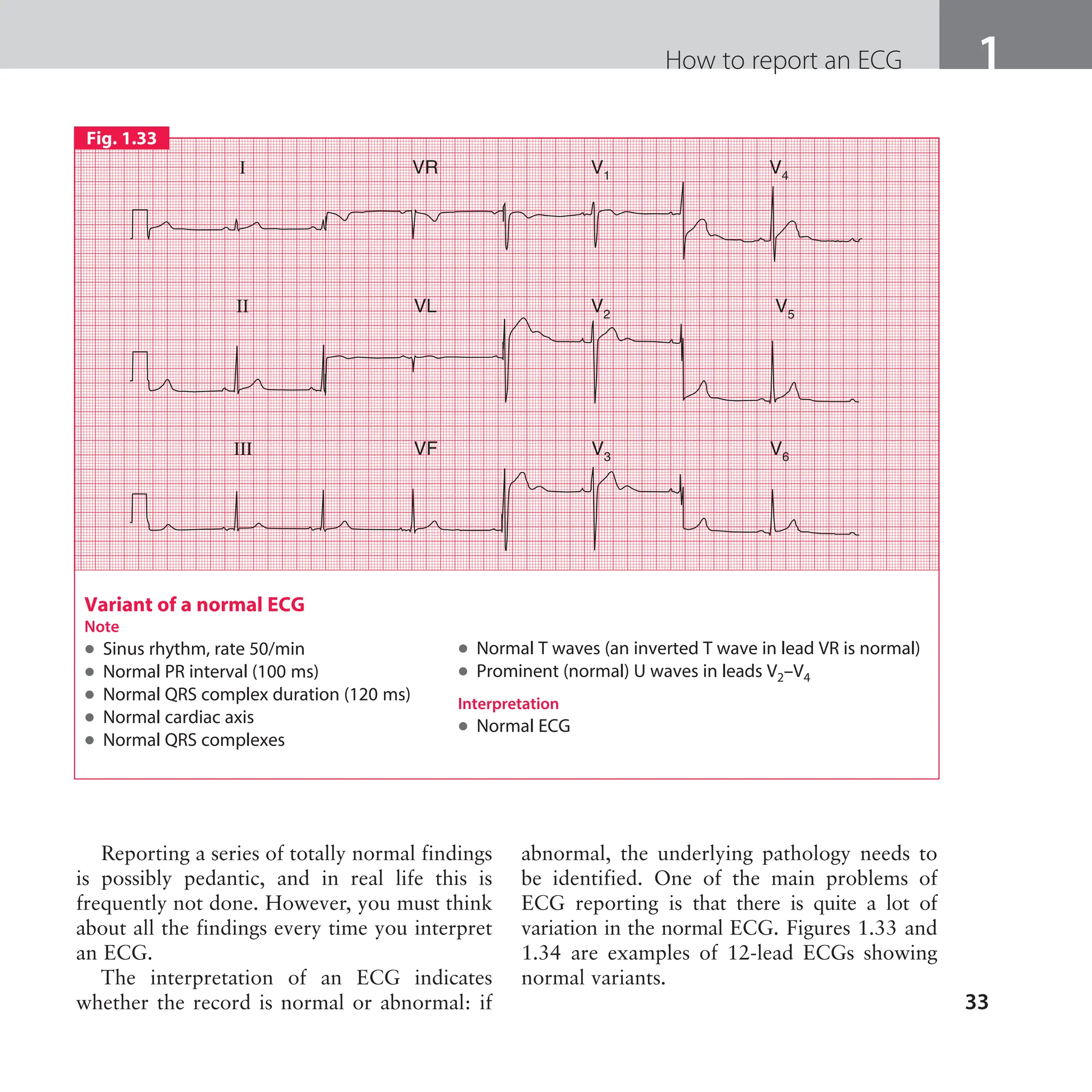 The ECG made easy guide. Guide on how to read ECG's quick and ...