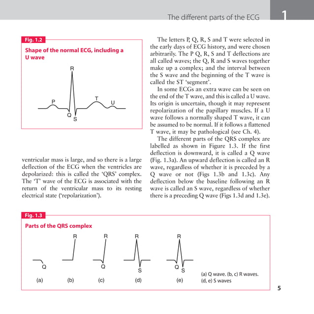 The ECG made easy guide. Guide on how to read ECG's quick and ...