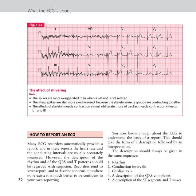 The ECG made easy guide. Guide on how to read ECG's quick and ...
