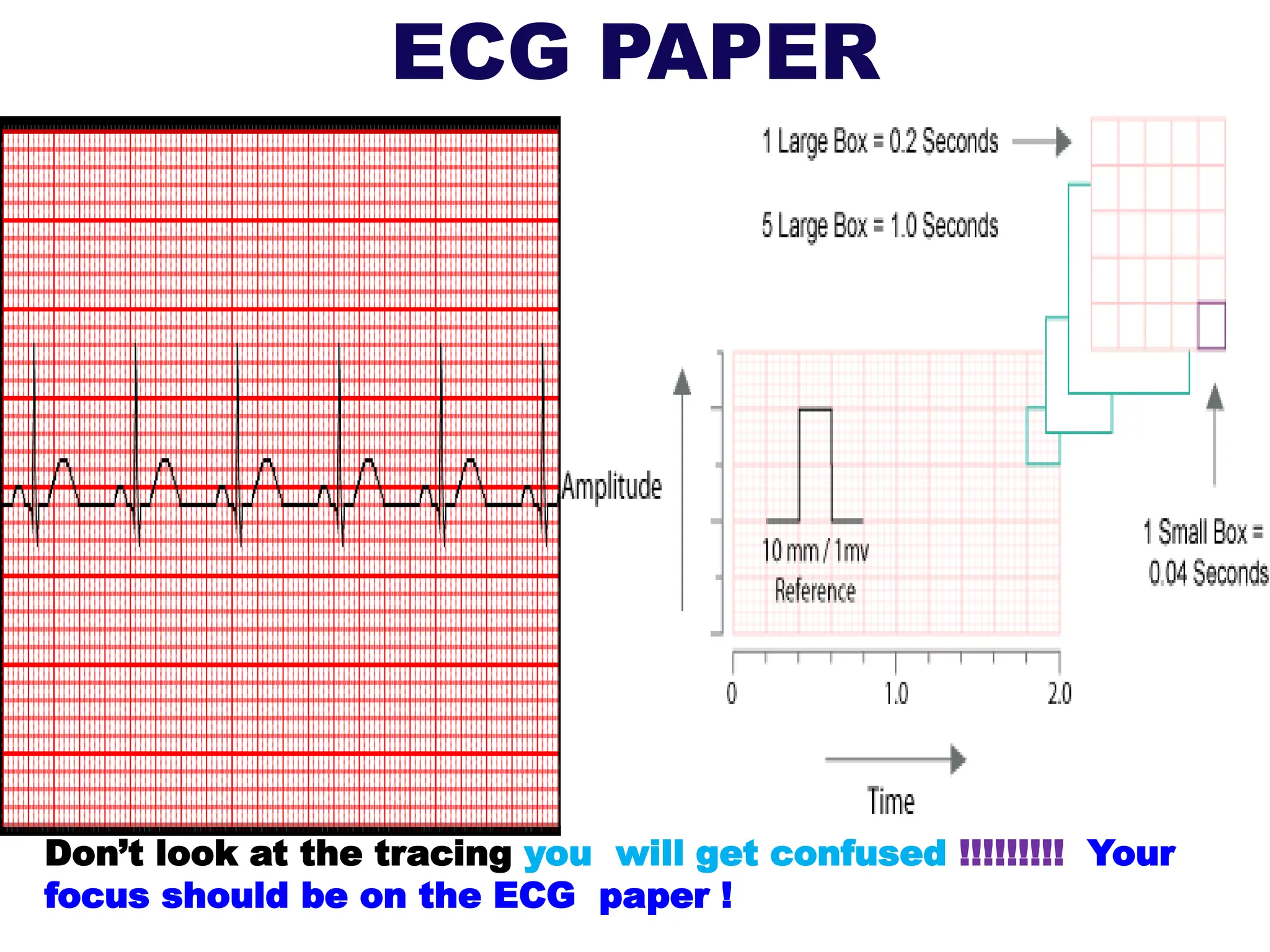 ECG PAPER
Don’t look at the tracing you will get confused !!!!!!!!! Your
focus should be on the ECG paper !
 