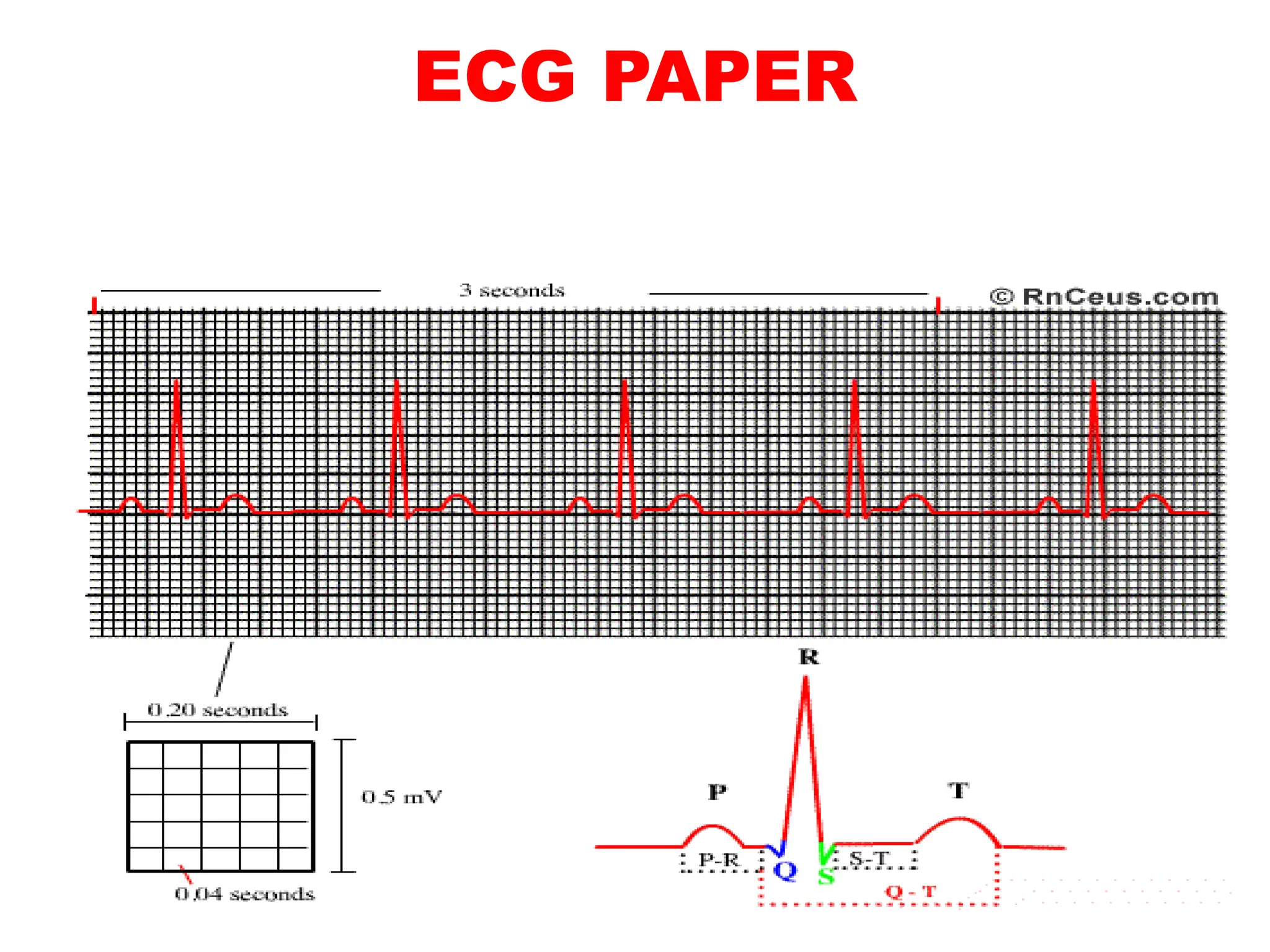 ECG PAPER
 