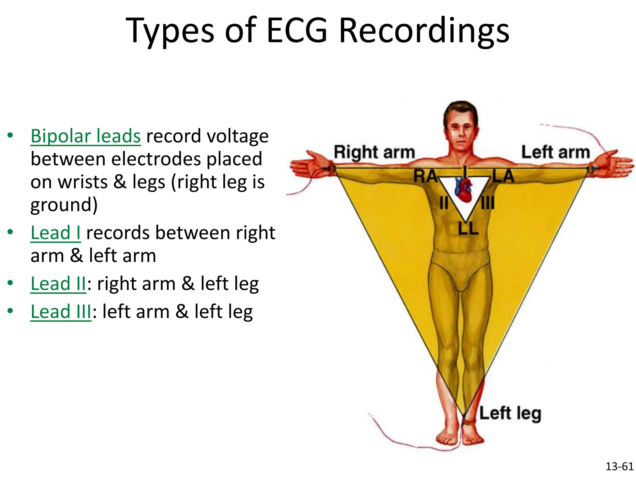 Types of ECG Recordings
• Bipolar leads record voltage
between electrodes placed
on wrists & legs (right leg is
ground)
• Lead I records between right
arm & left arm
• Lead II: right arm & left leg
• Lead III: left arm & left leg
13-61
 