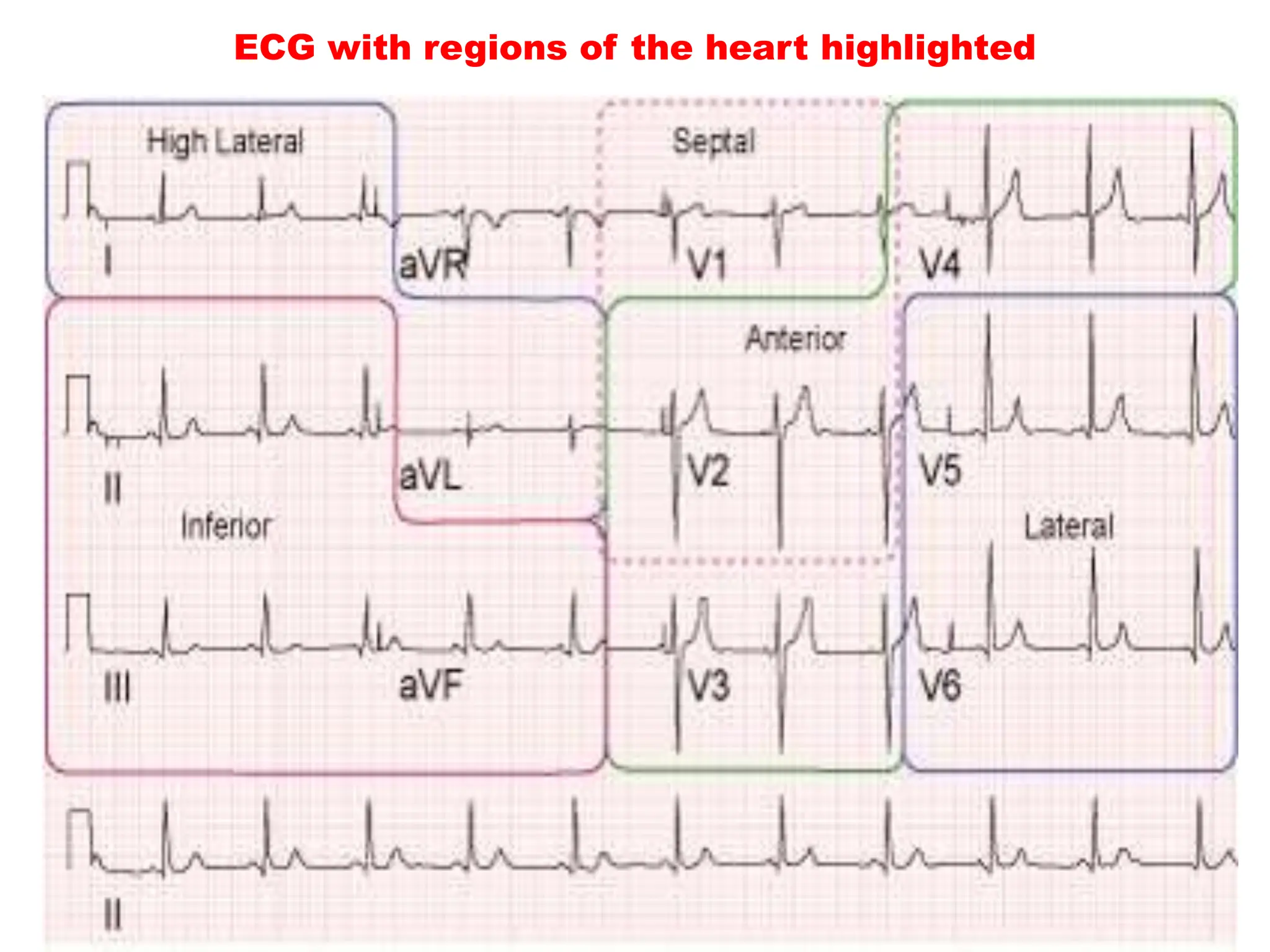 ECG with regions of the heart highlighted
 